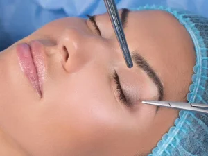 هزینه عمل بلفاروپلاستی