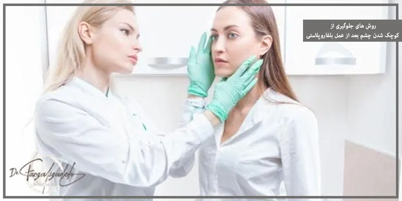 روش های جلوگیری از کوچک شدن چشم بعد از عمل بلفاروپلاستی