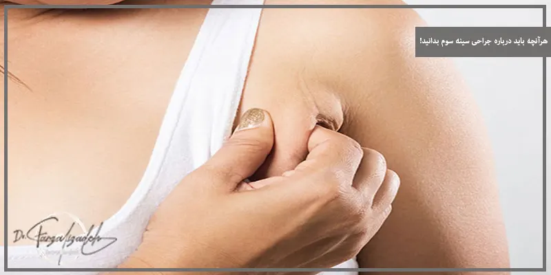 هرآنچه باید درباره جراحی سینه سوم بدانید