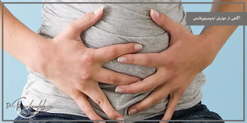 آگاهی از عوارض ابدومینوپلاستی
