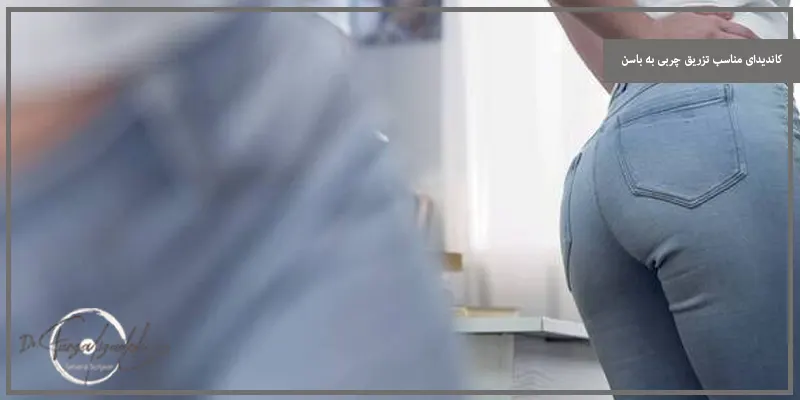کاندیدای مناسب تزریق چربی به باسن